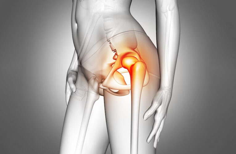 Osteoarthritis: Hip and Knee Diagnosis and Treatment